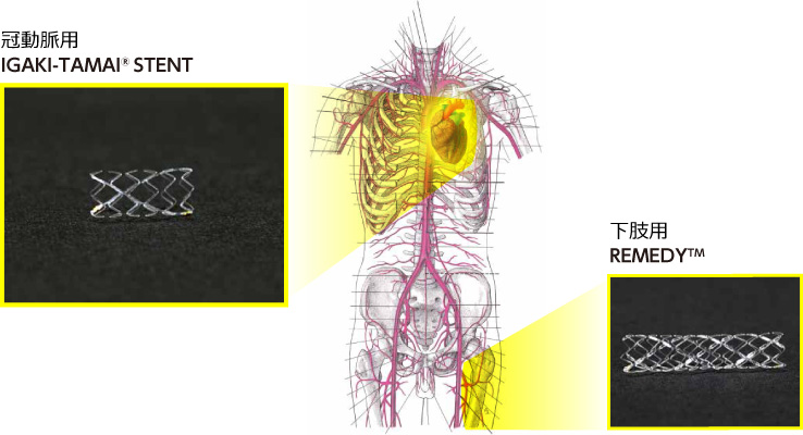 冠動脈用IGAKI-TAMAI® STENT　下肢用REMEDY™