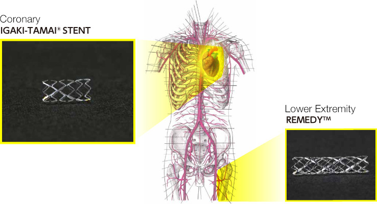 Coronary IGAKI-TAMAI® STENT　Lower Extremity REMEDY™